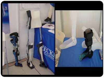 假肢與矯形器 功能、技術與應用概述